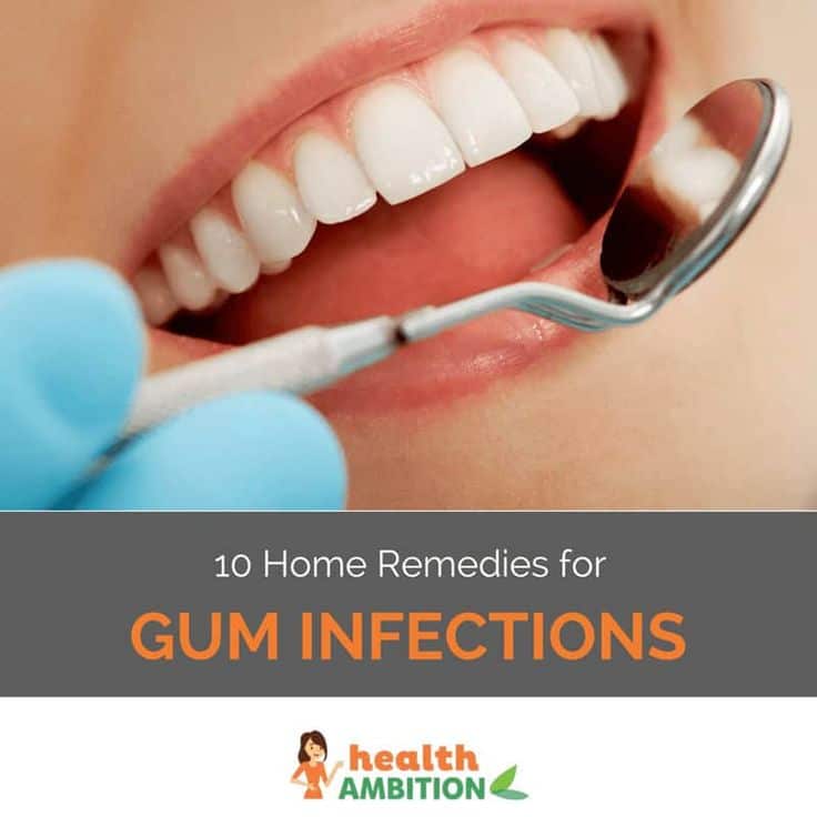 10 Home Remedies for Gum Infections