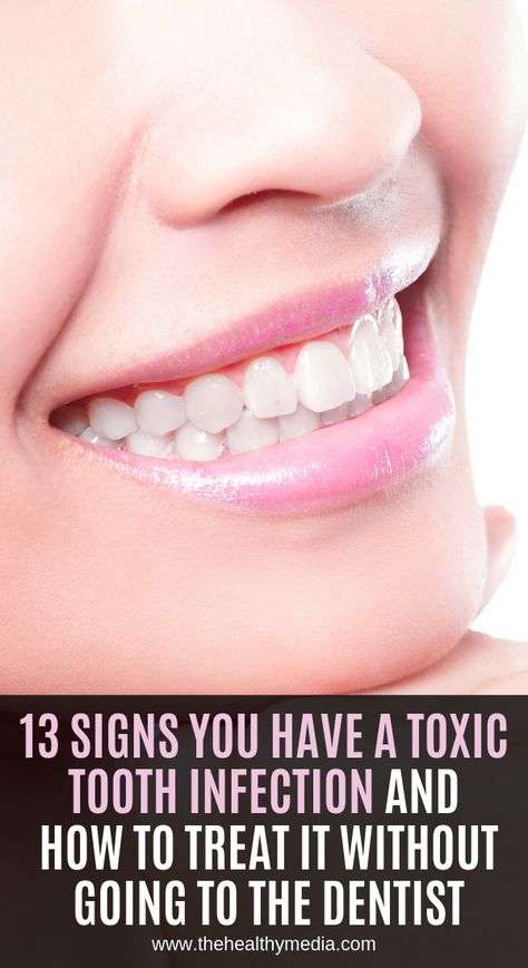 13 Signs You Have a TOXIC Tooth Infection and How to Treat ...