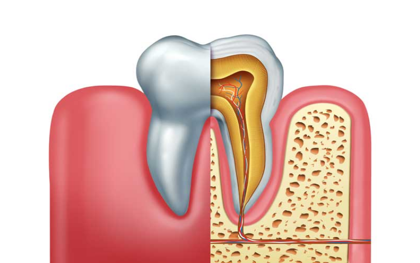3 Symptoms Of Root Canal Infection That Shouldnt Be Ignored