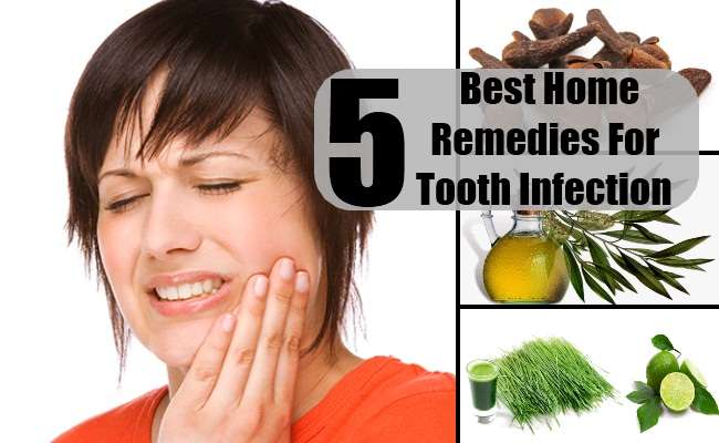5 Best Home Remedies For Tooth Infection