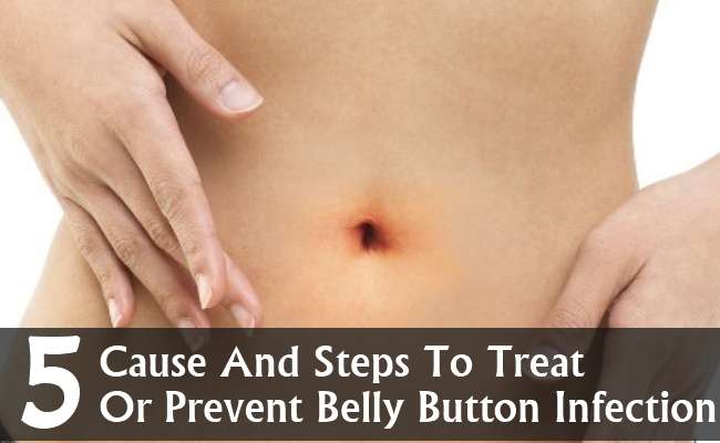 5 Cause And Steps To Treat Or Prevent Belly Button Infection In Women ...