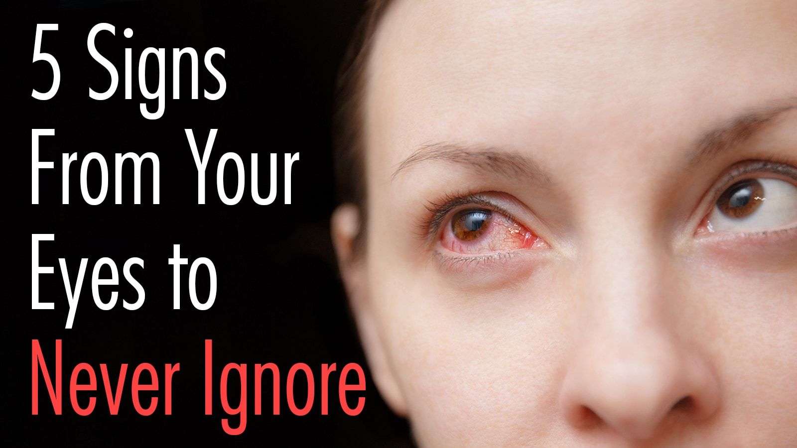 5 Signs From Your Eyes to Never Ignore