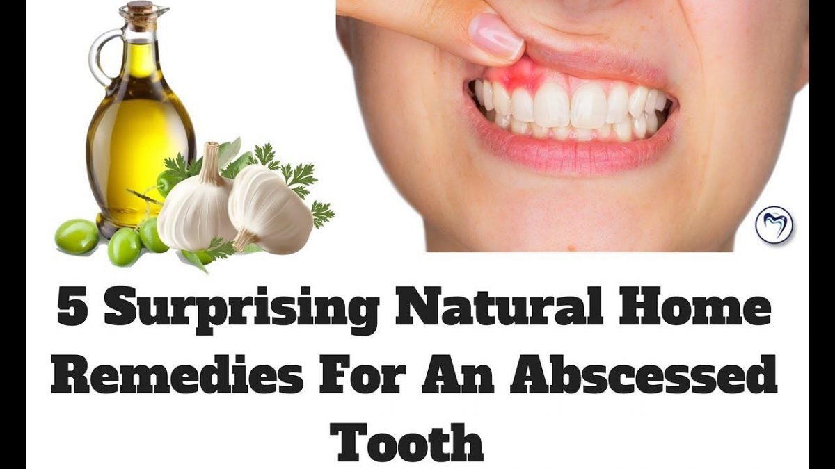 5 Surprising Natural Home Remedies For An Abscessed Tooth