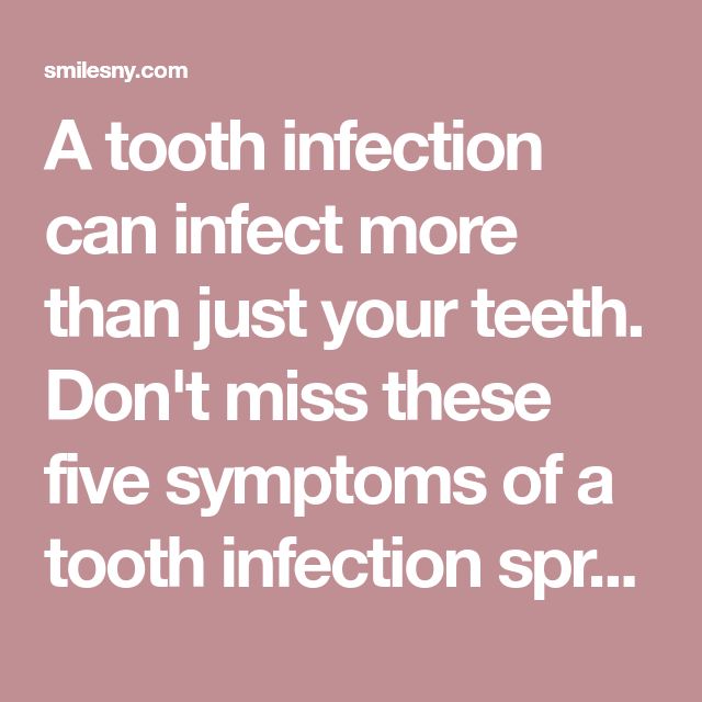 5 Symptoms of a Tooth Infection Spreading to the Rest of the Body ...