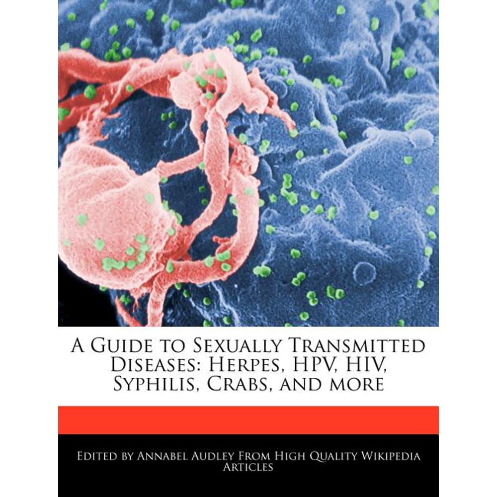 A Guide to Sexually Transmitted Diseases : Herpes, Hpv, HIV, Syphilis ...