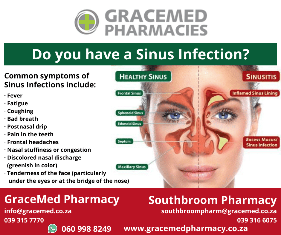 ã?ãã¹ãã³ã¬ã¯ã·ã§ã³ã sinus infection symptoms in adults teeth 120425