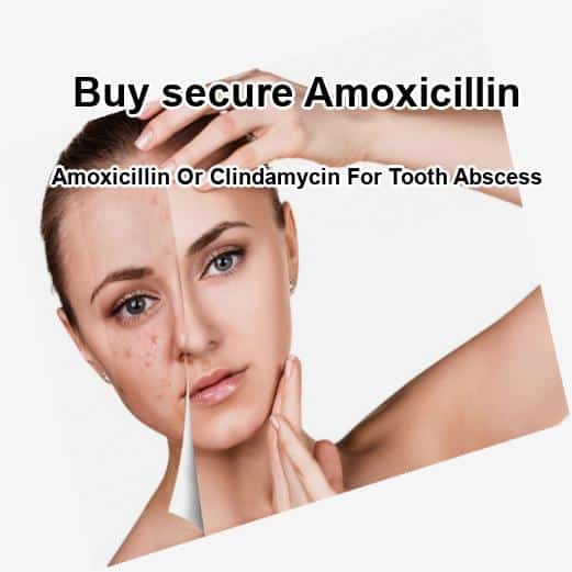 Amoxicillin or clindamycin for tooth abscess, amoxicillin or ...