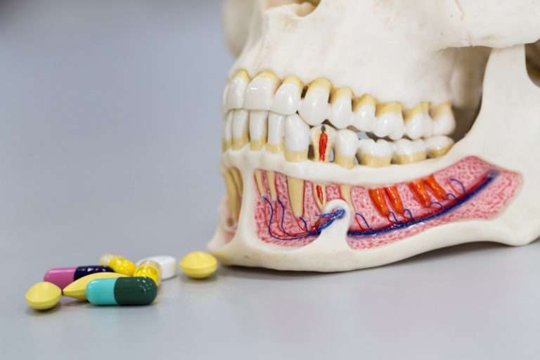 Antibiotics for Gum Disease: Best Prescription and OTC Options