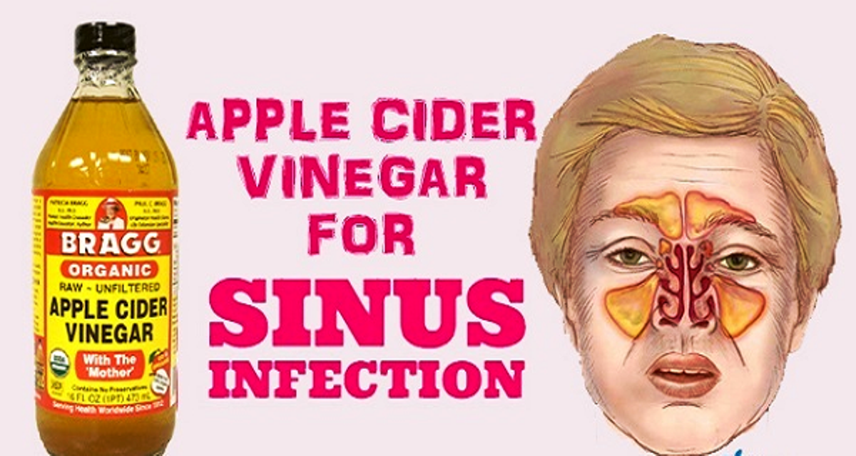 Apple Cider Vinegar And Sinuses: Here Are 5 Uses Of ACV ...
