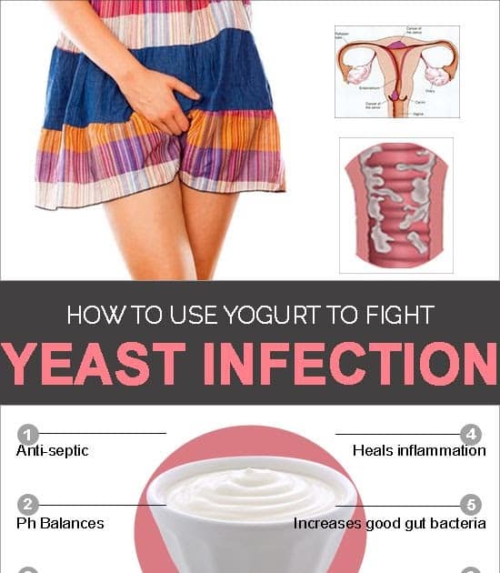 Ariehub: Yeast Infection Home Remedies For Itching In Private Parts