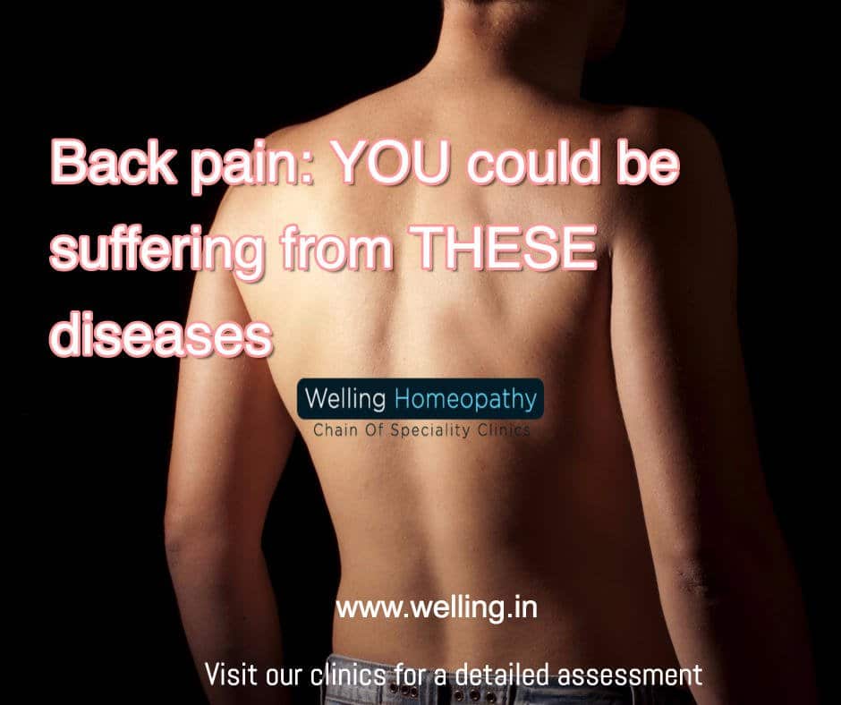 Back pain: YOU could be suffering from THESE diseases