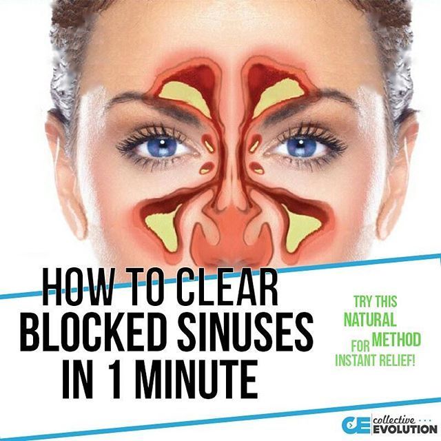 Best 25+ Blocked nose ideas on Pinterest