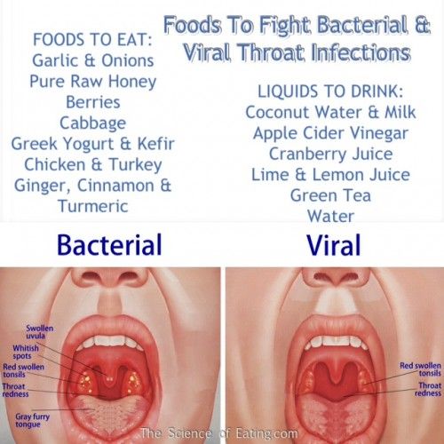 Best ideas about Viral Sore Throat Remedies, Sore Throat Natural ...
