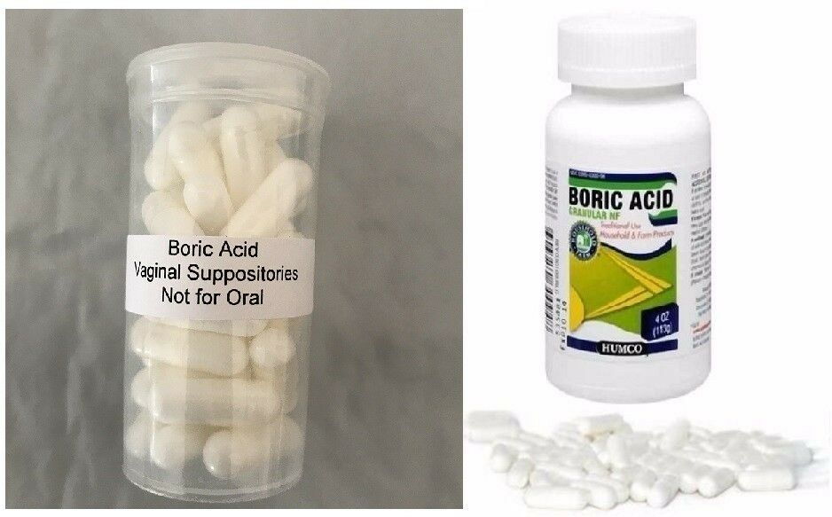 Boric Acid Tablets Yeast Infection : The 7 Best Over