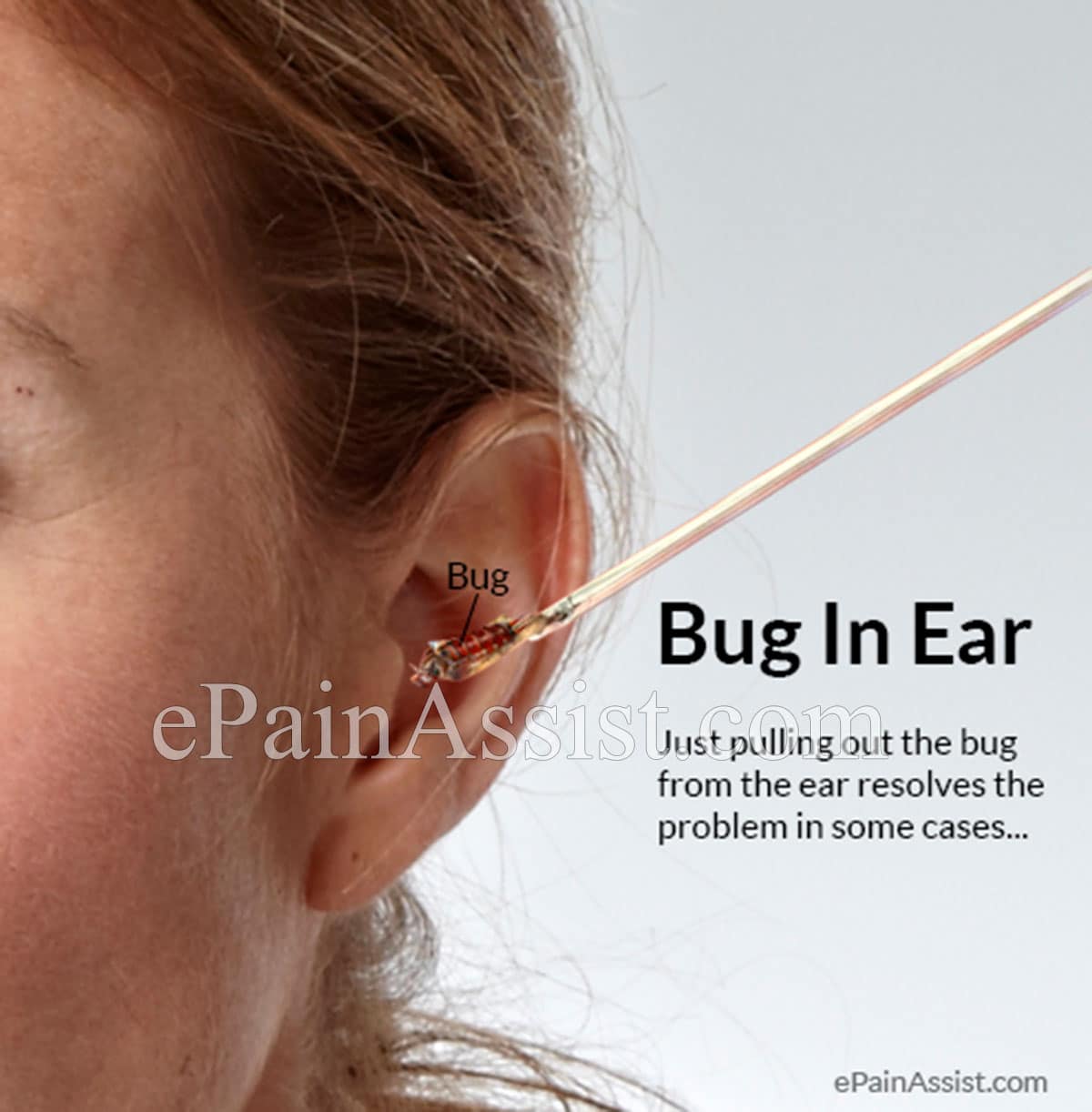 Bug In Ear: 7 Ways To Deal With Ear Pain and Discomfort in Ear