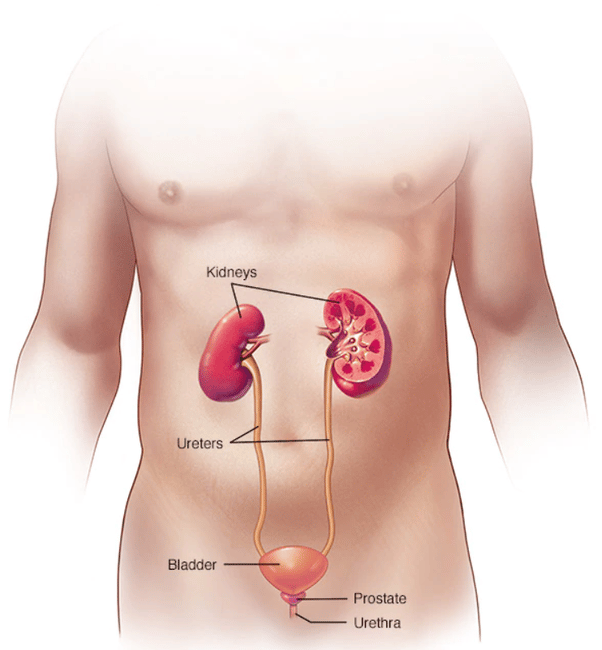 Can A Kidney Infection Heal On Its Own