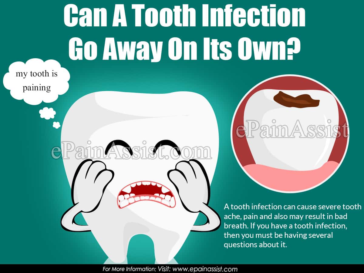 Can A Tooth Infection Go Away On Its Own?