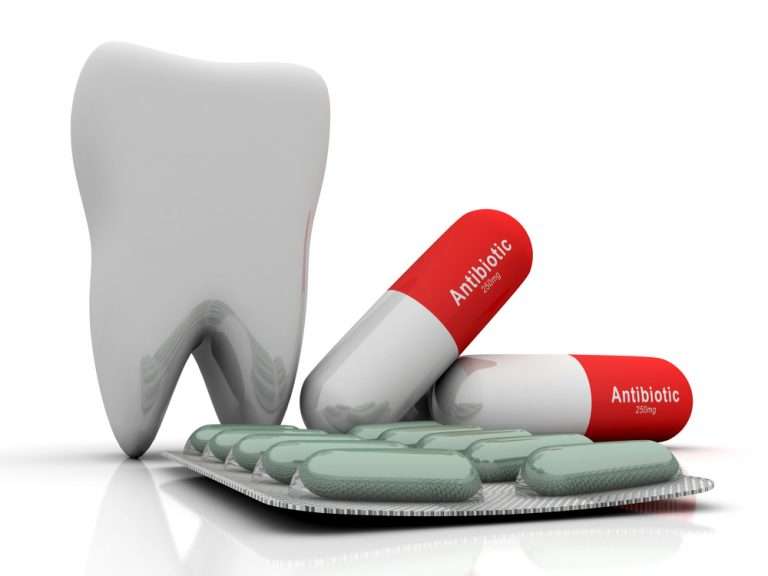 Can I Use Antibiotics for My Tooth Pain?
