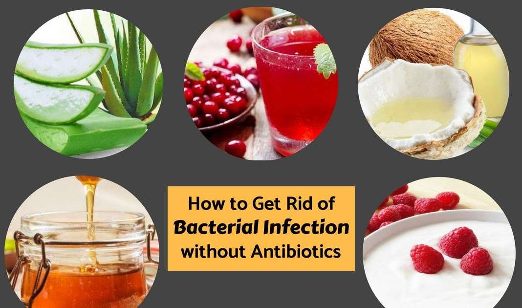 Can You Get Rid Of A Bacterial Infection Without Antibiotics?