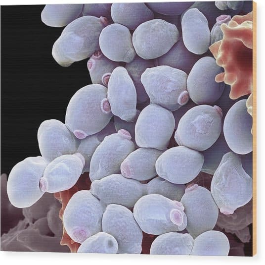 Candida Albicans Yeast Cells, Sem Photograph by Steve Gschmeissner