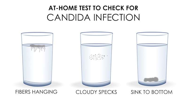 Candida Overgrowth: Complete Guide On Treating A Candida Infection