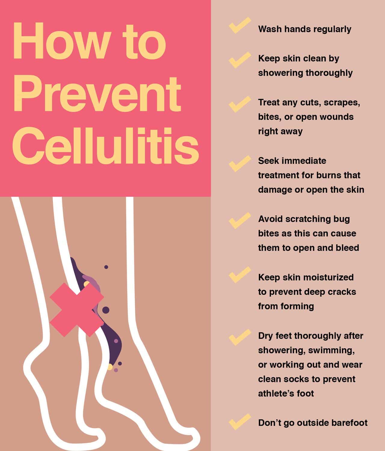 Cellulitis Skin Infection: Causes and How Do to Treat It?