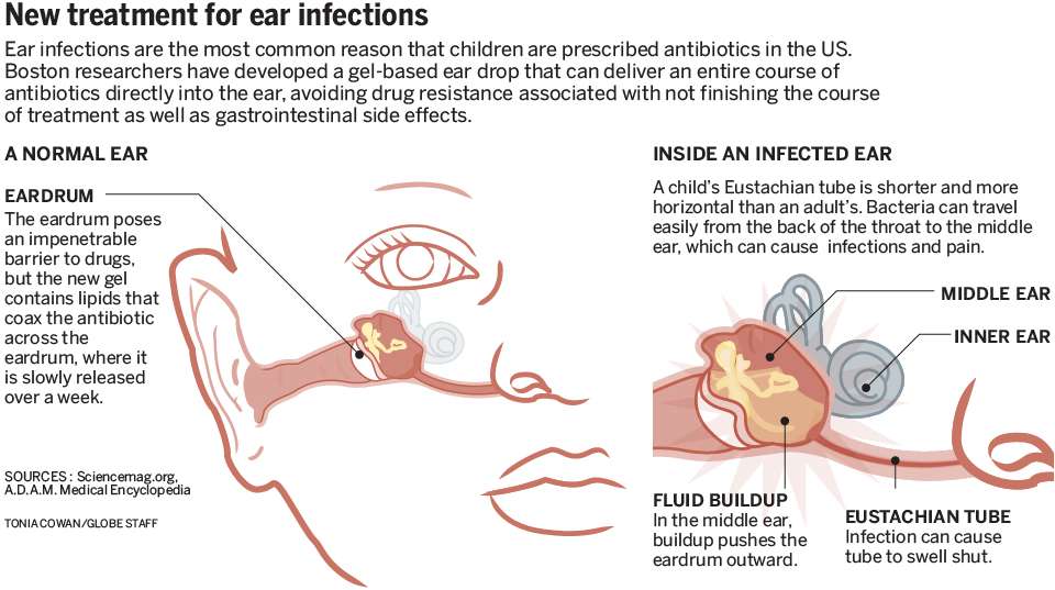 Childhood Diseases  On a Mission to Educate: Ear ...