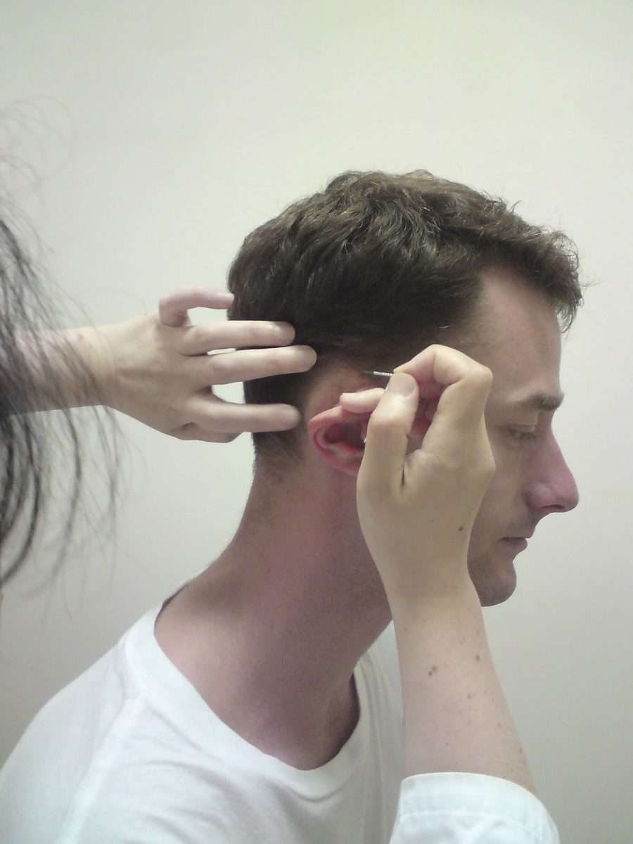 Chinese Medicine Adventures with Damien Bodnarchuk: Acupuncture for ear ...