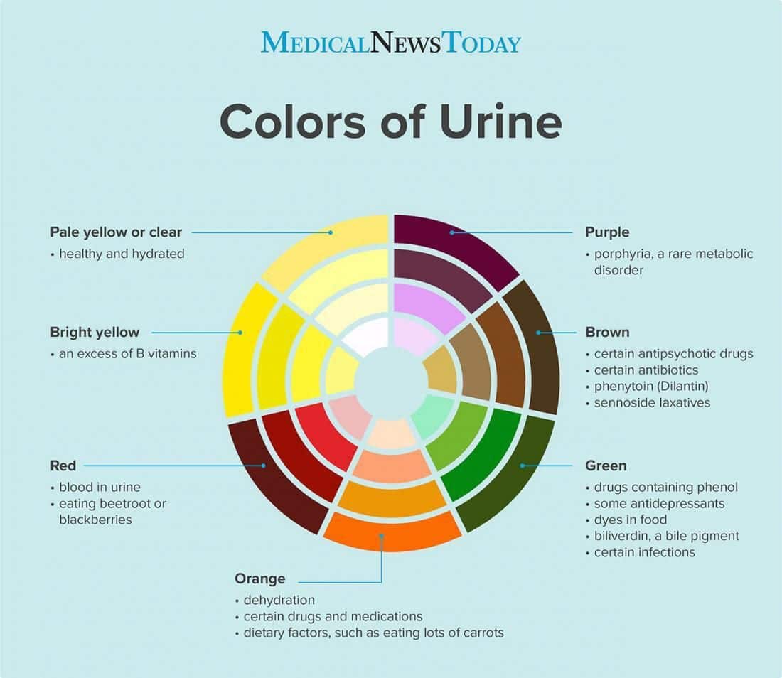 Color and corresponding meaning of urine color.