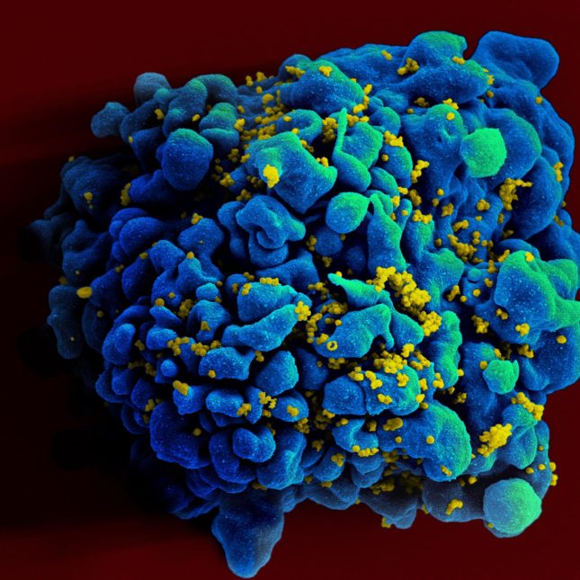 CRISPR identifies genes that might be targeted to hobble HIV infection