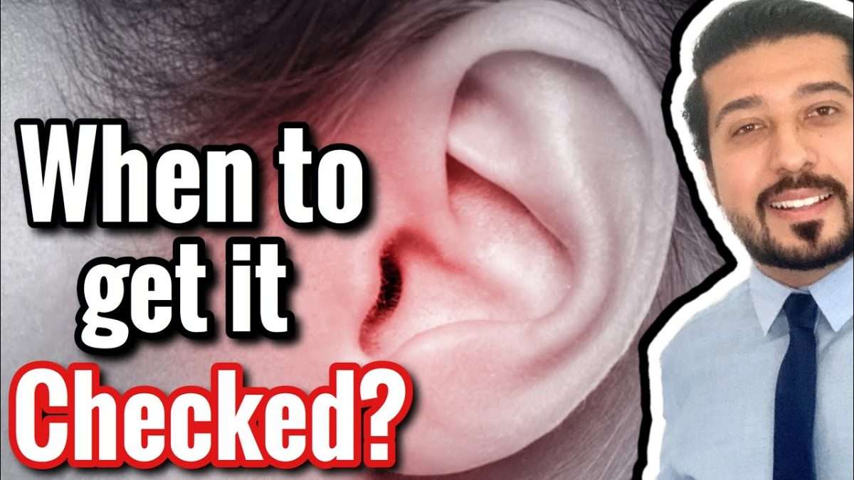 EAR INFECTION or Otitis Media