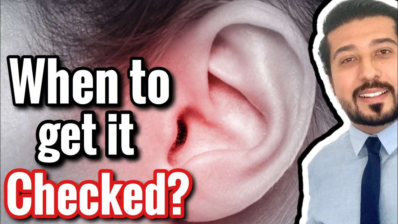EAR INFECTION or Otitis Media