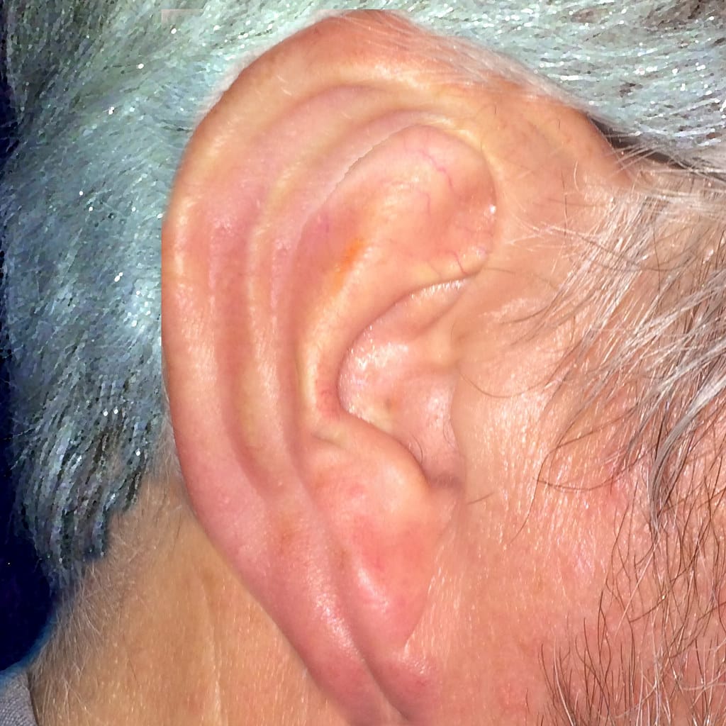 Ear infection,Earn pain,Causes and Treatment