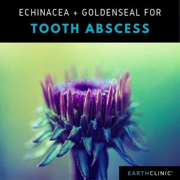Echinacea, Goldenseal for Tooth Abscess