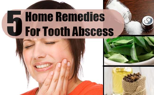 Effective Home Remedies For Tooth Abscess