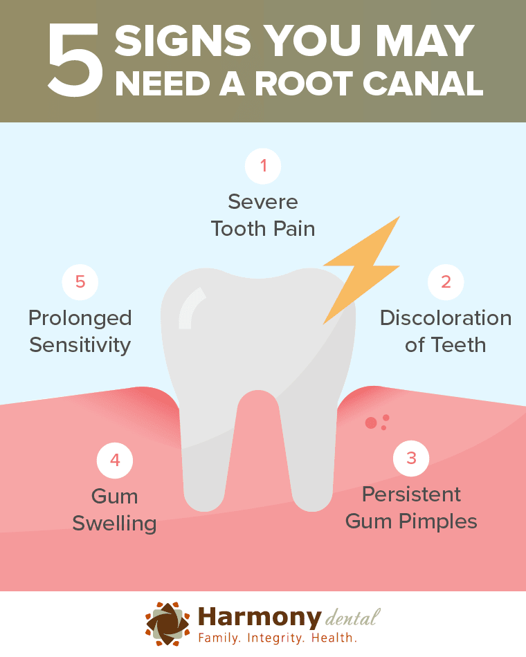 Emergency Root Canals: Your Guide to Relief