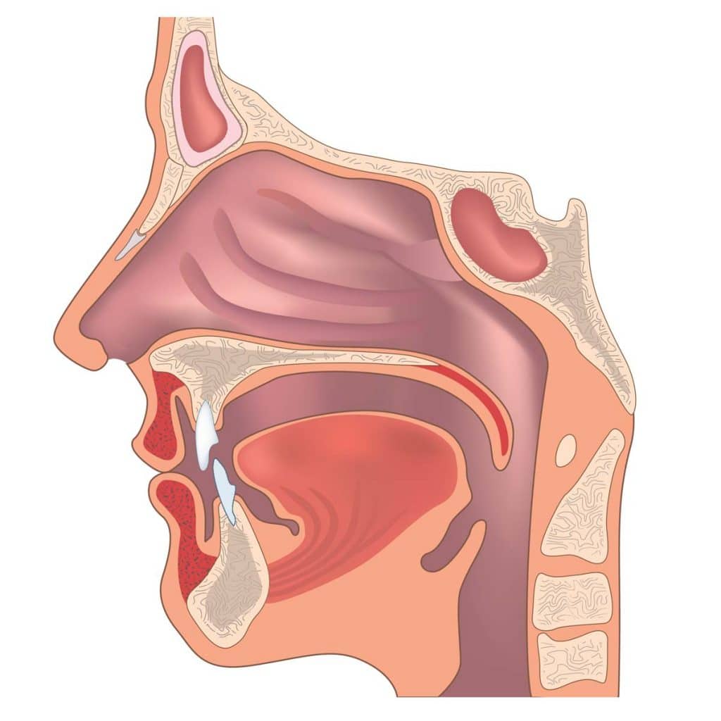 ENT (Ear, Nose, Throat) specialist