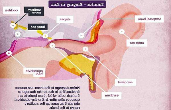 Expert says: Migraine hearing loss tinnitus : sinusitis tinnitus ...