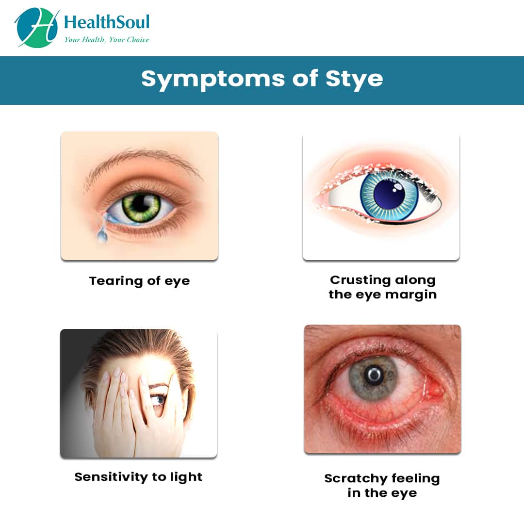 Eye Diseases Stye