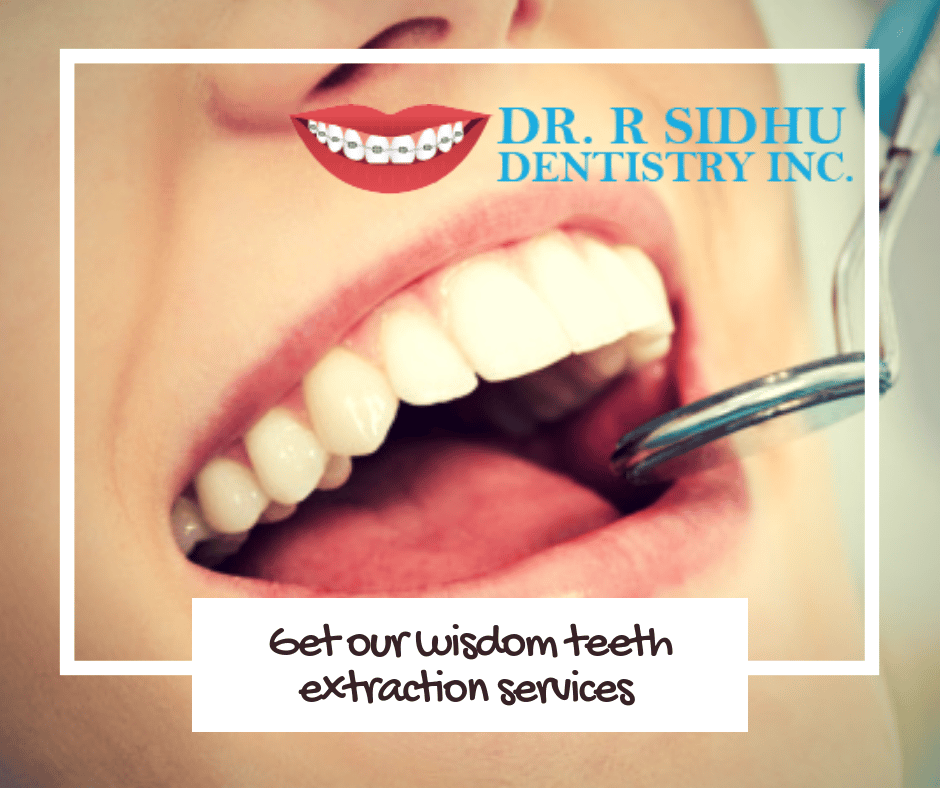 Get Our Wisdom Teeth Extraction Services