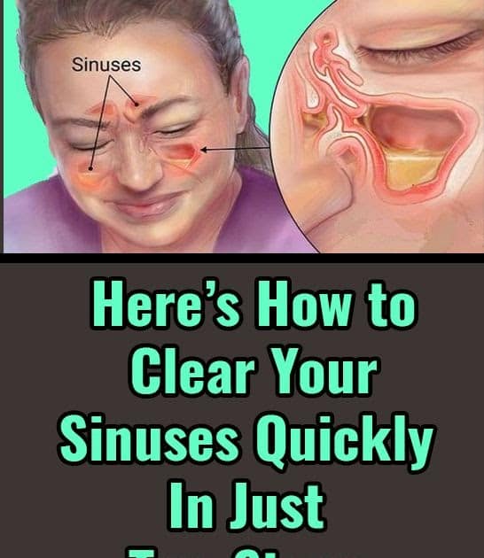 health and fitness: Heres How to Clear Your Sinuses Quickly In Just ...
