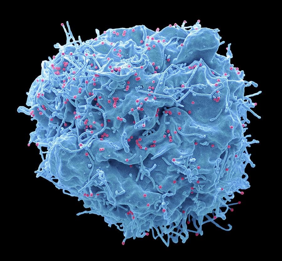 Hiv Infected Cell Photograph by Steve Gschmeissner/science Photo ...