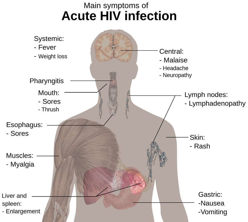 HIV Infection: Causes, Symptoms, Stages of HIV Infection, Treatment
