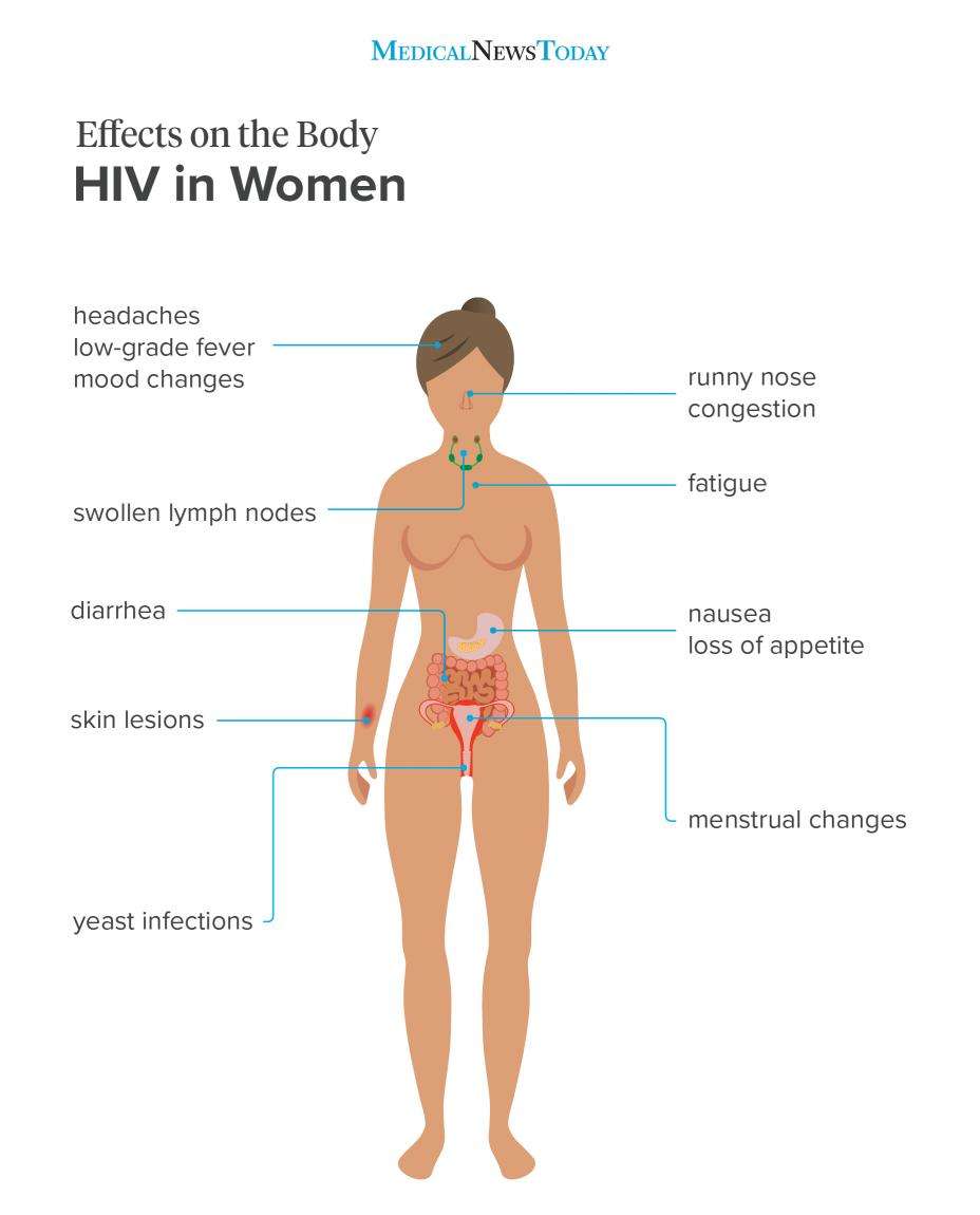 HIV signs and symptoms in women