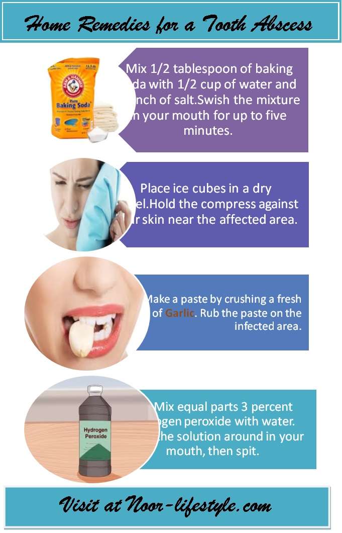 Home Remedies for a Tooth Abscess
