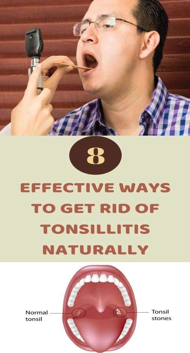 Home Remedies For Tonsillitis: