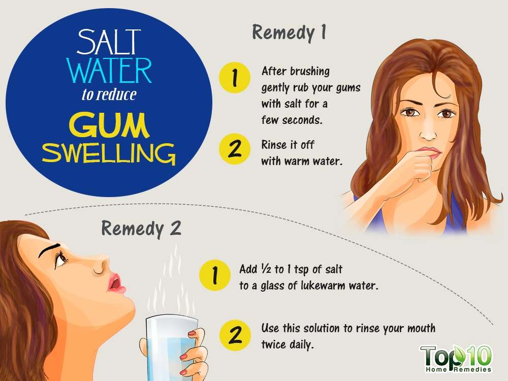 Home Remedies to Reduce Gum Swelling