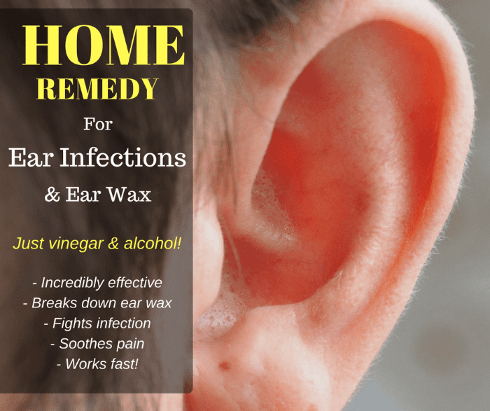 Home Remedy For Earwax &  Ear Infections