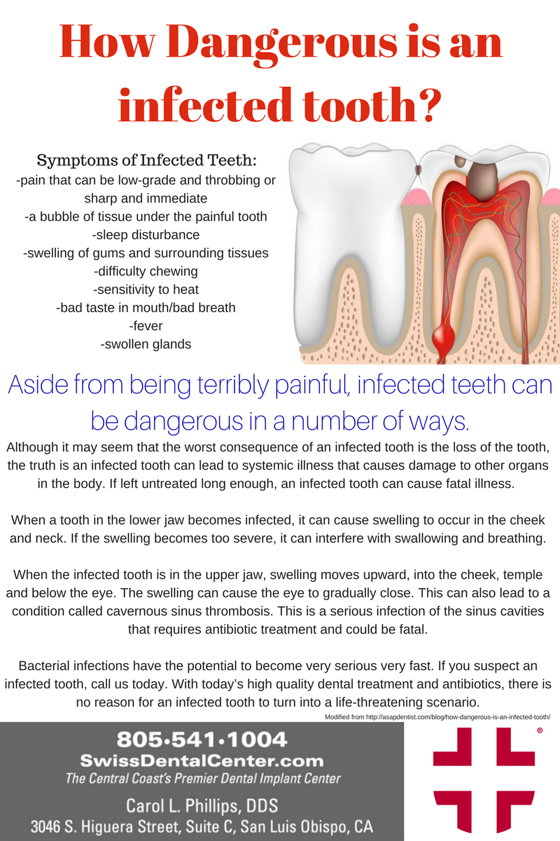 How Dangerous Is An Infected Tooth?