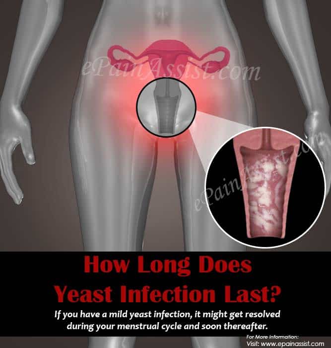 How Long Does Yeast Infection Last &  How to Get Rid of It?